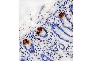 Immunohistochemical analysis of paraffin-embedded H. (LYZ 抗体  (C-Term))