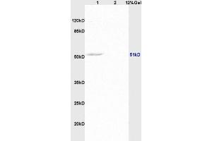 Lane 1: rat brain lysates Lane 2: human colon carcinoma lysates probed with Anti AVPR2 Polyclonal Antibody, Unconjugated (ABIN735398) at 1:200 in 4 °C.