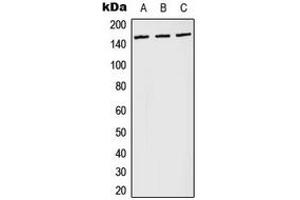 Western blot analysis of PLC gamma 1 (pY783) expression in Jurkat pervanadate-treated (A), NIH3T3 LPS-treated (B), PC12 H2O2-treated (C) whole cell lysates. (Phospholipase C gamma 1 抗体  (pTyr783))