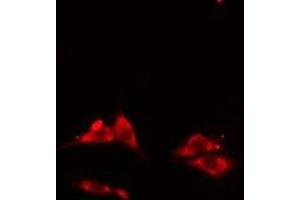 ABIN6275601 staining HepG2 cells by IF/ICC. (Sorting Nexin 3 抗体  (Internal Region))