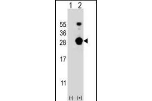 Western blot analysis of FKBP7 (arrow) using rabbit polyclonal FKBP7 Antibody (C-term) (ABIN656813 and ABIN2846027). (FKBP7 抗体  (C-Term))
