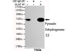 Immunoprecipitation analysis of Hela cell lysates using Pyruvate Dehydrogenase E2 mouse mAb. (CYB561 抗体)
