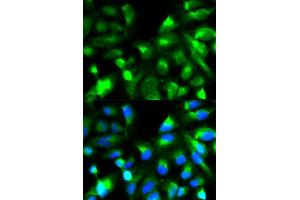 Immunofluorescence analysis of HeLa cell using SNAP25 antibody. (SNAP25 抗体  (AA 1-206))