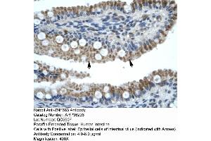 Human Intestine (ZNF683 抗体  (N-Term))