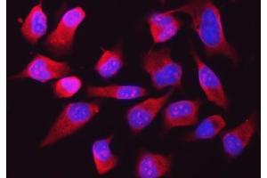 IF analysis of RPL32 using anti-RPL32 antibody (ABIN7602916). (RPL32 抗体  (C-Term))