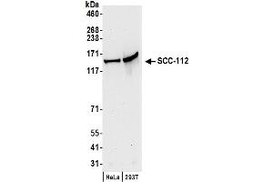 anti-PDS5, Regulator of Cohesion Maintenance, Homolog A (PDS5A) (C-Term) antibody
