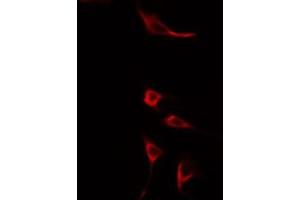ABIN6275602 staining HuvEc cells by IF/ICC. (Sorting Nexin 4 抗体  (Internal Region))