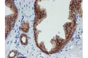 Image no. 9 for anti-Mannose Phosphate Isomerase (MPI) antibody (ABIN1499545) (MPI 抗体)