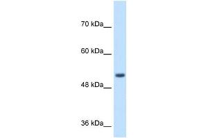 SPPL2B antibody used at 1 ug/ml to detect target protein. (SPPL2B 抗体  (N-Term))