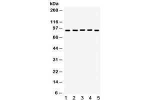 Western blot testing of 1) rat brain, 2) rat testis, 3) human HeLa, 4) SKOV and 5) SW620 lysate with EWSR1 antibody.