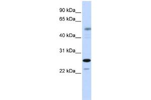 WB Suggested Anti-PSMC3IP Antibody Titration:  0.