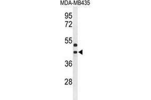 Western blot analysis of GPR17 (arrow) in MDA-MB435 cell line lysates (35ug/lane) using GPR17 (GPR17 抗体  (Middle Region))