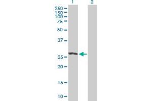 Western Blot analysis of RIT2 expression in transfected 293T cell line by RIT2 MaxPab polyclonal antibody. (RIT2 抗体  (AA 1-217))
