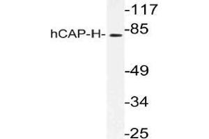Western blot (WB) analysis of hCAP-H antibody in extracts from K562 cells. (NCAPH 抗体)