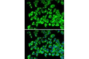 Immunofluorescence analysis of MCF7 cells using RPL13 antibody (ABIN1682571, ABIN5664631, ABIN5664633 and ABIN6220492). (RPL13 抗体  (AA 1-211))