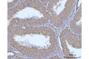 IHC analysis of OCRL using anti-OCRL antibody (ABIN7599572).
