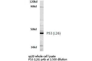 Western blot (WB) analyzes of P53 antibody in extracts from SP20 cells. (p53 抗体)