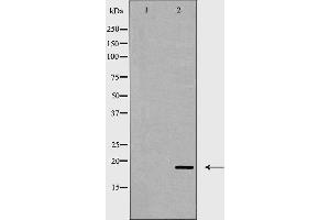 Western blot analysis of CD3 ζ expression in Jurkat cell lysate .