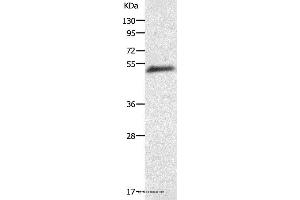 Western blot analysis of Human liver cancer tissue, using AGT Polyclonal Antibody at dilution of 1:200 (AGT 抗体)