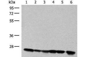 Western blot analysis of 293T cell and Human fetal liver tissue lysates using DTYMK Polyclonal Antibody at dilution of 1:550 (DTYMK 抗体)
