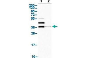 Western Blot analysis with SLAMF6 polyclonal antibody . (SLAMF6 抗体  (AA 152-224))