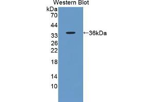 Detection of Recombinant AKAP12, Human using Polyclonal Antibody to A Kinase Anchor Protein 12 (AKAP12) (AKAP12 抗体  (AA 1485-1782))