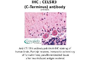 Image no. 1 for anti-Cadherin EGF LAG Seven Pass G-Type Receptor 3 (CELSR3) (C-Term) antibody (ABIN1732973)