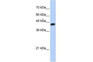 WB Suggested Anti-E2F1 Antibody Titration:  0. (E2F1 抗体  (N-Term))