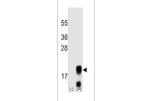 Western blot analysis of FSHB/FSH (arrow) using mouse polyclonal FSHB/FSH antibody (Center) (ABIN658910 and ABIN2837836). (FSHB 抗体  (AA 36-64))