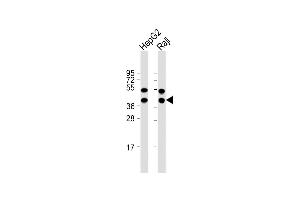 All lanes : Anti-TXNL2 Antibody (N-term) at 1:1000 dilution Lane 1: HepG2 whole cell lysate Lane 2: Raji whole cell lysate Lysates/proteins at 20 μg per lane.