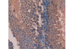 #VALUE! (Olfactomedin 3 抗体  (AA 245-406))