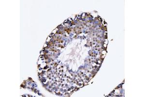 IHC analysis of KIFC1 using anti-KIFC1 antibody (ABIN7599523).