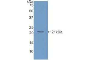 Detection of Recombinant ARPC4, Human using Polyclonal Antibody to Actin Related Protein 2/3 Complex Subunit 4 (ARPC4) (ARPC4 抗体  (AA 3-165))