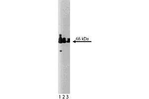 Western blot analysis of Paxillin on a human endothelial lysate.