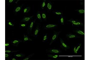 Immunofluorescence of monoclonal antibody to STK24 on HeLa cell. (STK24 抗体  (AA 1-431))