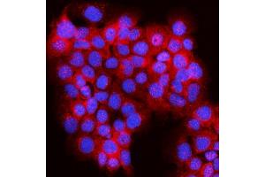 IF analysis of JLP/SPAG9 using anti-JLP/SPAG9 antibody (ABIN7601091). (SPAG9 抗体  (AA 281-964))