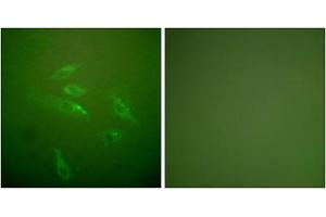 Immunofluorescence analysis of HeLa cells, using Collagen Type III antibody. (COL3 抗体  (N-Term))