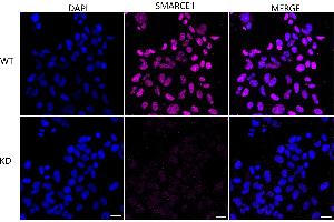Immunocytochemical staining of HeLa cells using SMARCE1 antibody (ABIN7800481), 1:1,000), Top panel: wild-type (WT), Bottom panal: SMARCE1 shRNA knockdown (KD).