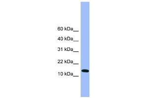 WB Suggested Anti-Atp5d Antibody Titration: 0. (ATP5F1D 抗体  (C-Term))