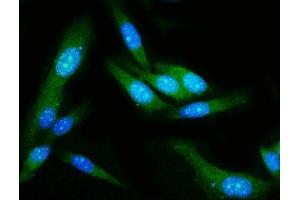 IF analysis of GSDMD using anti-GSDMD antibody (ABIN7599433).