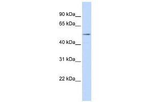 WB Suggested Anti-SUV420H1 AntibodyTitration: 1. (SUV420H1 抗体  (Middle Region))