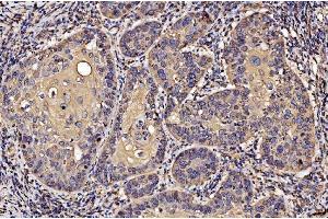 IHC analysis of PDIA6 using anti-PDIA6 antibody (ABIN7600554). (PDIA6 抗体  (AA 20-440))