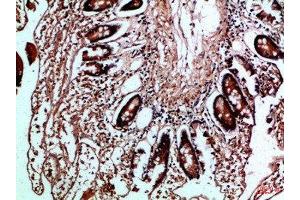 Immunohistochemical analysis of paraffin-embedded Human-colon, antibody was diluted at 1:100 (HLA-DMB 抗体  (AA 40-100))