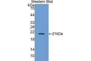 Detection of Recombinant NOS2, Mouse using Polyclonal Antibody to Nitric Oxide Synthase 2, Inducible (NOS2) (NOS2 抗体  (AA 43-213))