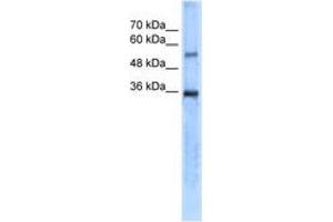Image no. 1 for anti-Carbonic Anhydrase VIII (CA8) (AA 31-80) antibody (ABIN204988) (CA8 抗体  (AA 31-80))