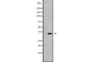 Western blot analysis of TSSK3 expression in A431 whole cell lysate ,The lane on the left is treated with the antigen-specific peptide.