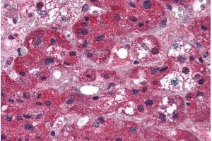 Immunohistochemistry (IHC) image for anti-Ariadne Homolog, Ubiquitin-Conjugating Enzyme E2 Binding Protein, 1 (ARIH1) (C-Term) antibody (ABIN184915)