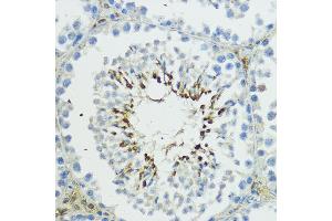 Immunohistochemistry (IHC) image for anti-Thyroid Hormone Receptor Interactor 12 (TRIP12) (AA 1-240) antibody (ABIN6149543)