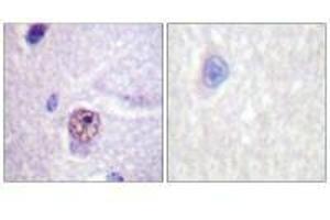 Immunohistochemistry analysis of paraffin-embedded human brain tissue using SF1 (Ab-82) antibody. (Splicing Factor 1 抗体  (Ser82))
