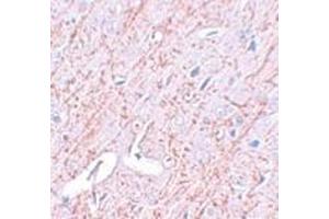 Immunohistochemistry (Paraffin-embedded Sections) (IHC (p)) image for anti-GATA Binding Protein 3 (GATA3) (C-Term) antibody (ABIN499877)